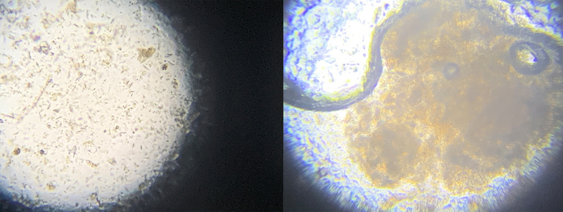 Microscopic exams (pictured above) help identify the bacteria population and health of the treatment system and next steps to improve efficiency.
